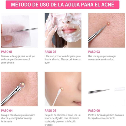 REMOVEDOR DE PUNTOS NEGROS